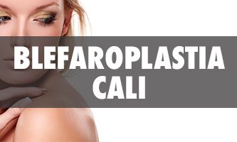 Blefaroplastia en Cali - Cirujanos Plásticos Certificados