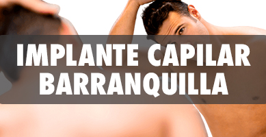 Implante Capilar en Barranquilla - Cirujanos Plásticos Certificados