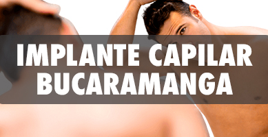Implante Capilar en Bucaramanga - Cirujanos Plásticos Certificados