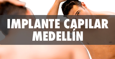 Implante Capilar en Medellín - Cirujanos Plásticos Certificados