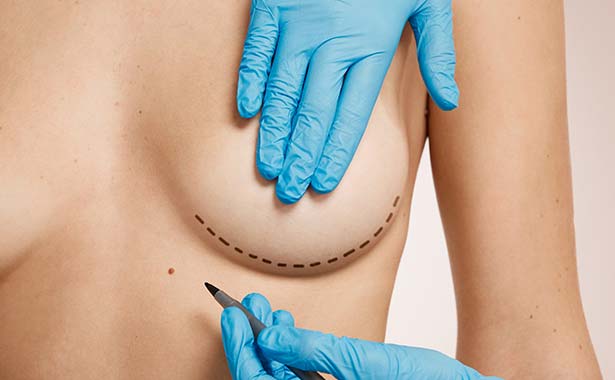 Cirugía Plástica Mujeres - Cirujanos Plásticos Certificados